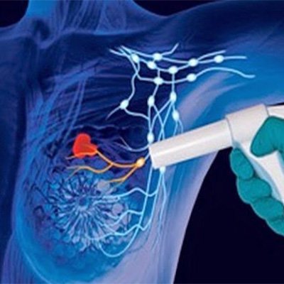 pérdida de sangre del cáncer de próstata del cuerpo 2